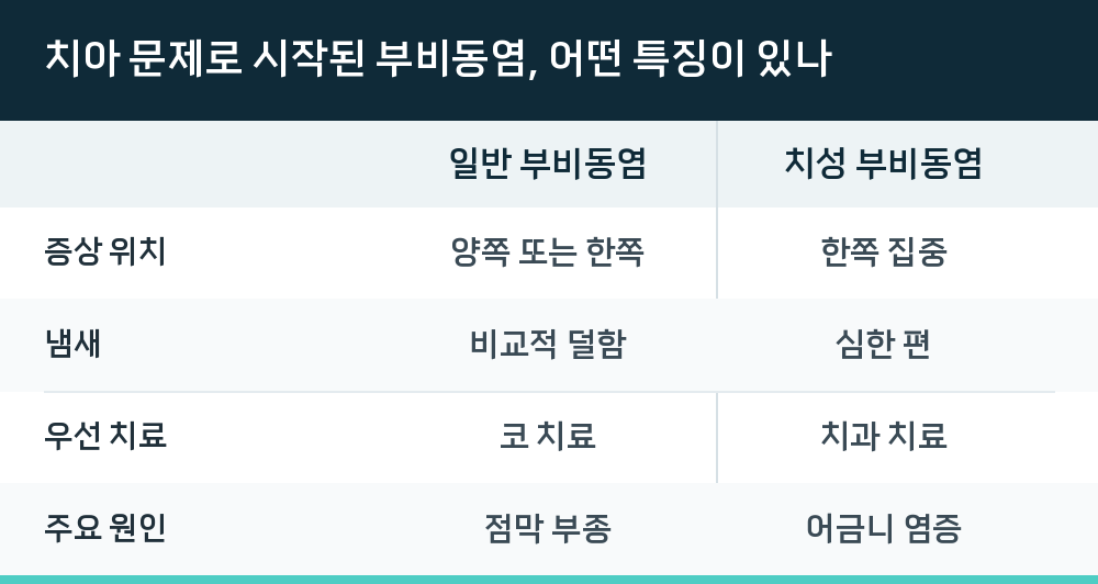치아 문제로 시작된 부비동염, 어떤 특징이 있나