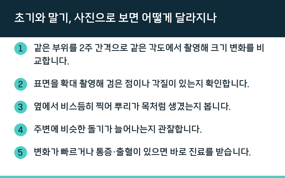 초기와 말기, 사진으로 보면 어떻게 달라지나