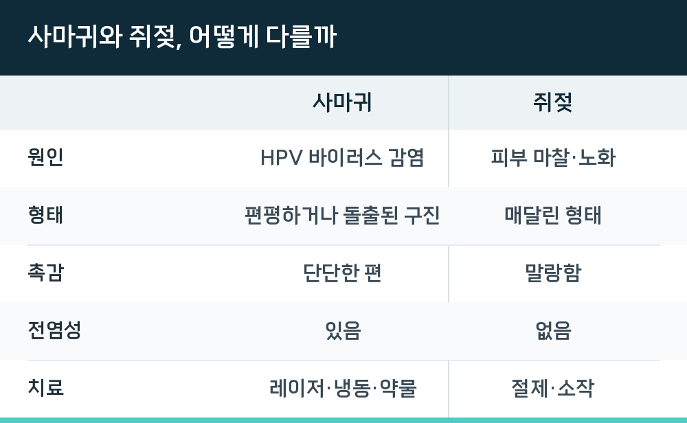 사마귀와 쥐젖, 어떻게 다를까